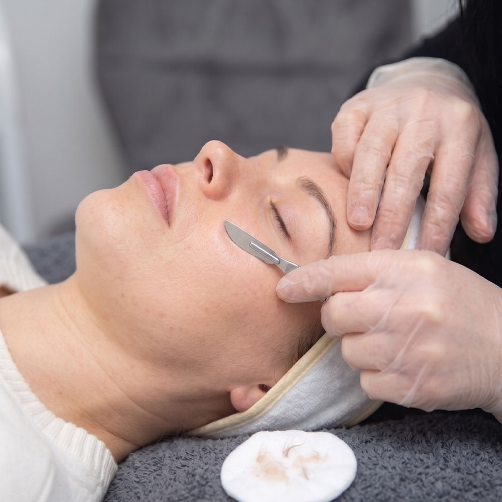 Close-up of a woman receiving dermaplaning facial; esthetician wearing gloves uses scalpel to remove peach fuzz