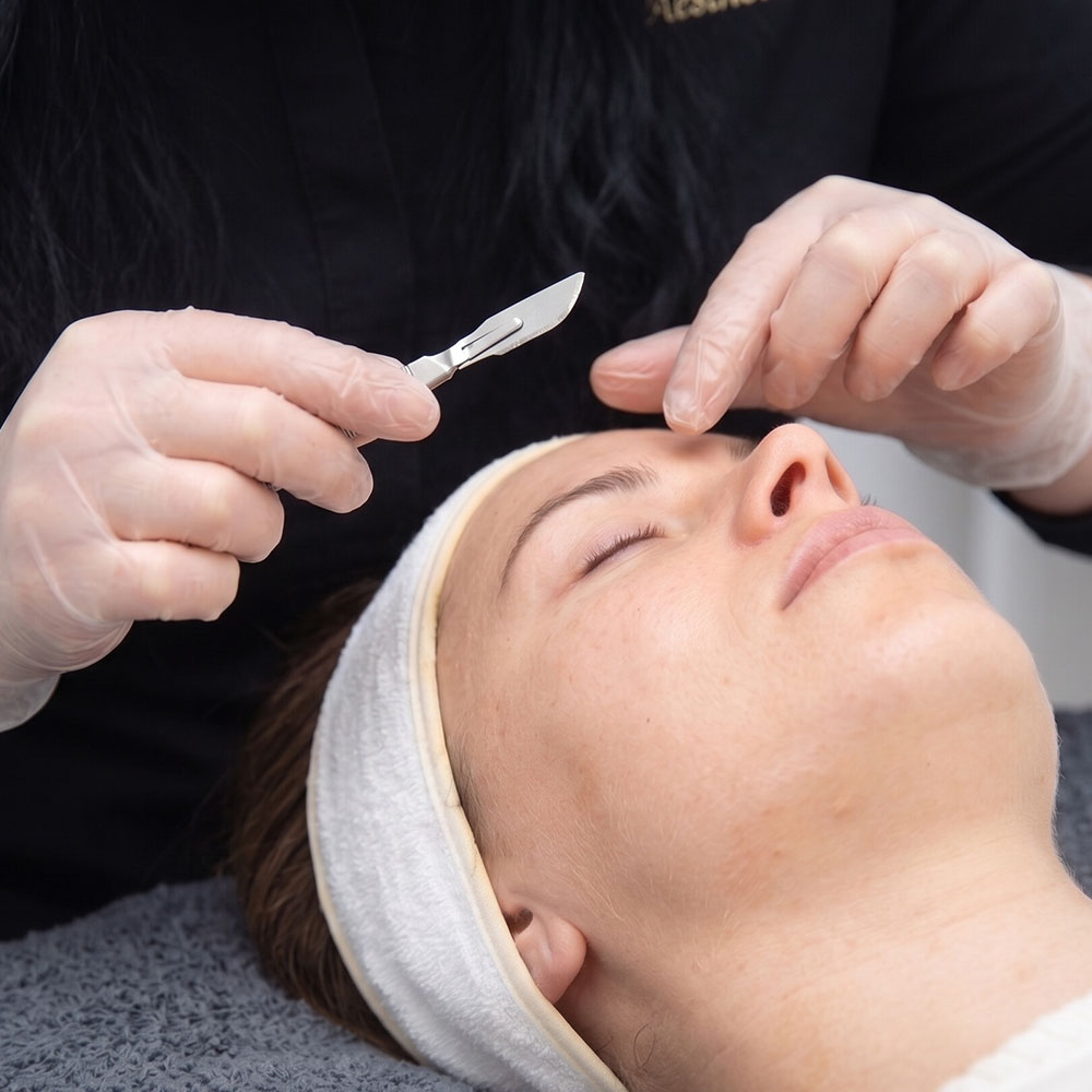Esthetician performing dermaplaning facial on a woman with headband, close-up of scalpel and gloved hands.