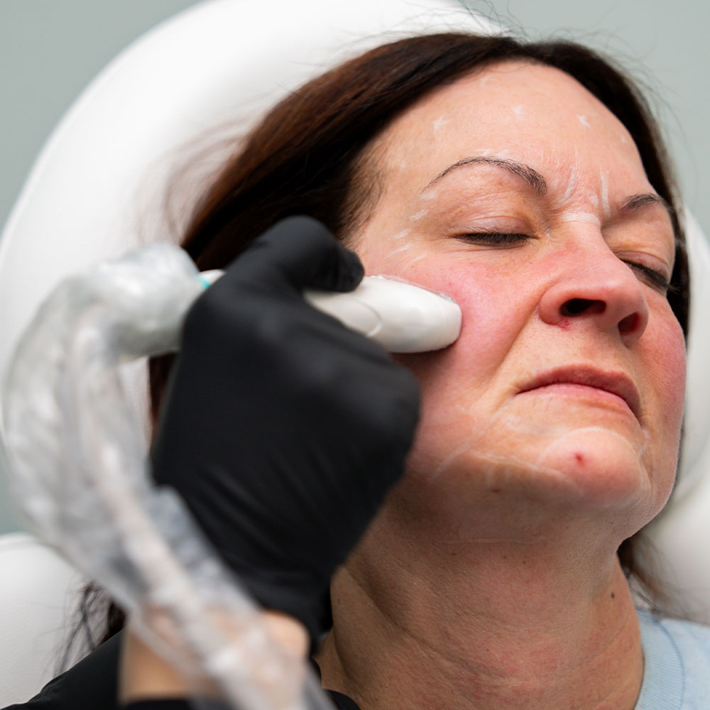 A woman receiving a professional facial skin treatment with a handheld device on her cheek at an aesthetic clinic.