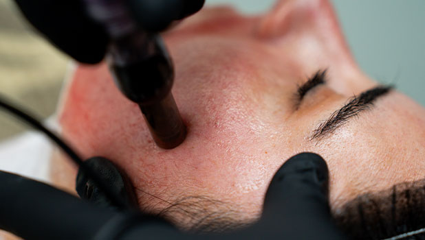A person receiving a professional facial skin treatment with a handheld device, esthetician wearing black gloves