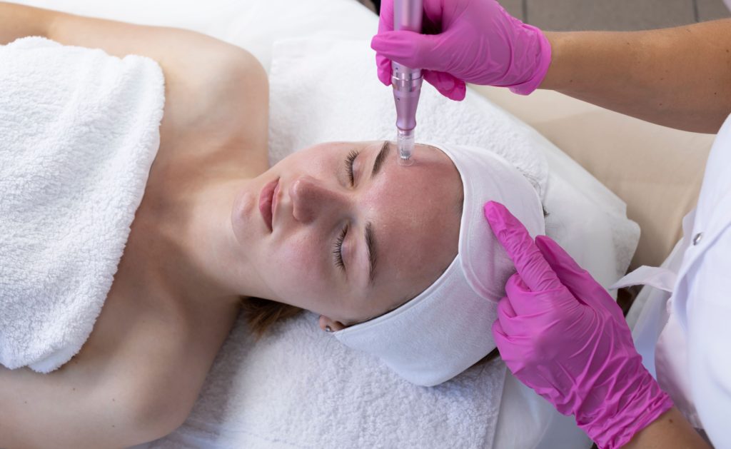 Woman receiving microneedling facial with dermapen as technician in pink gloves treats her forehead